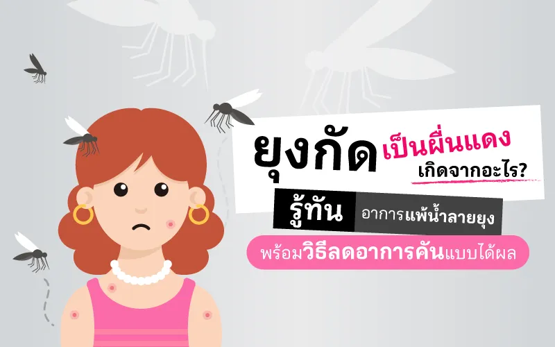ยุงกัดเป็นผื่นแดง เกิดจากอะไร 01 Cover Tmn